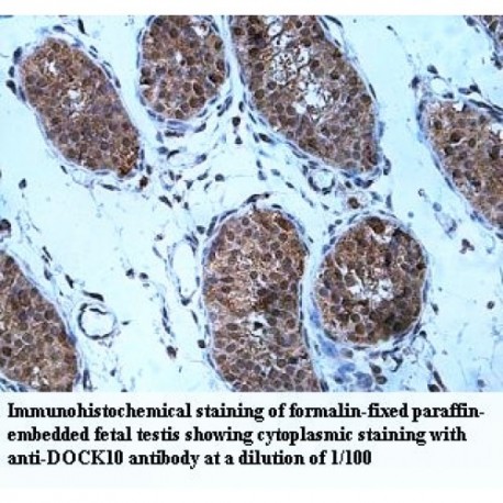 DOCK10 Antibody