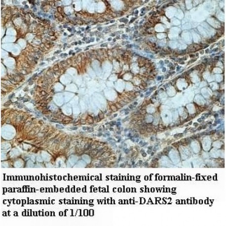 DARS2 Antibody