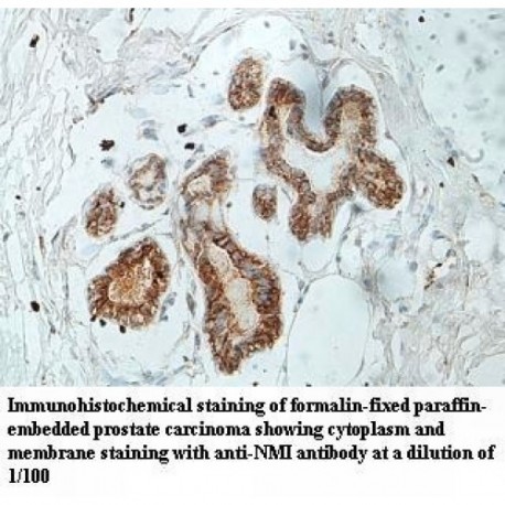 NMI Antibody