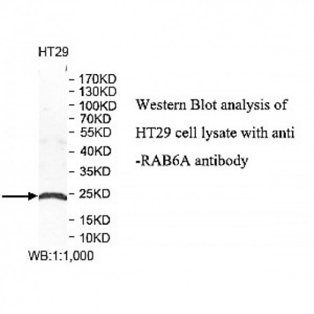 RAB6A Antibody