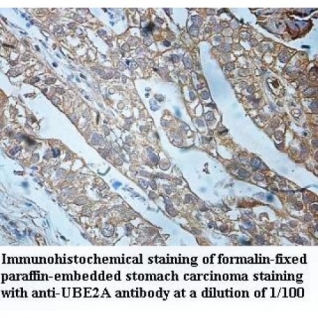 UBE2A Antibody