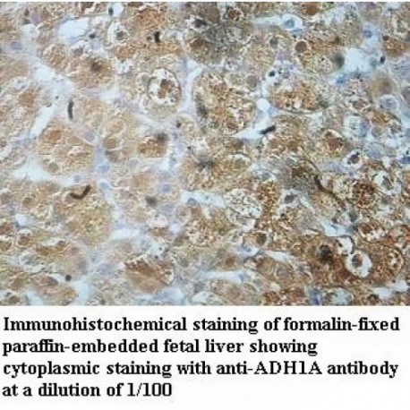 ADH1A Antibody