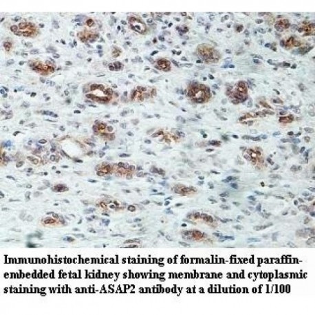 ASAP2 Antibody