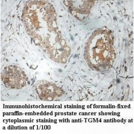 TGM4 Antibody