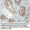 TGM4 Antibody