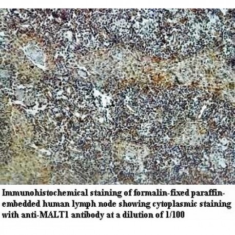 MALT1 Antibody