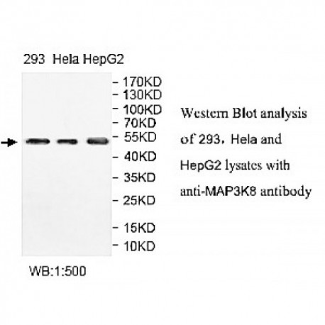 MAP3K8 Antibody