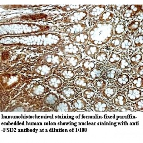 FSD2 Antibody