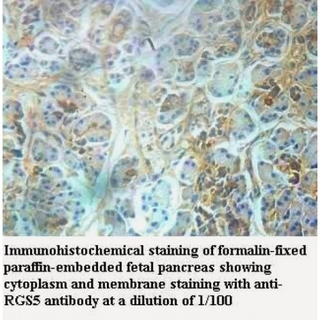 RGS5 Antibody