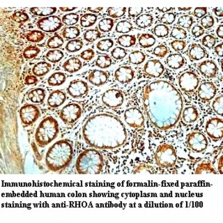 RHOA Antibody