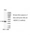 AKR1CL2 Antibody