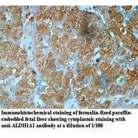 ALDH1A1 Antibody