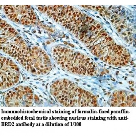 BRD2 Antibody