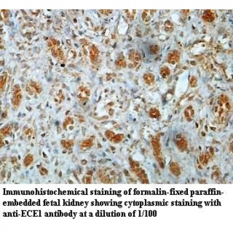 ECE1 Antibody