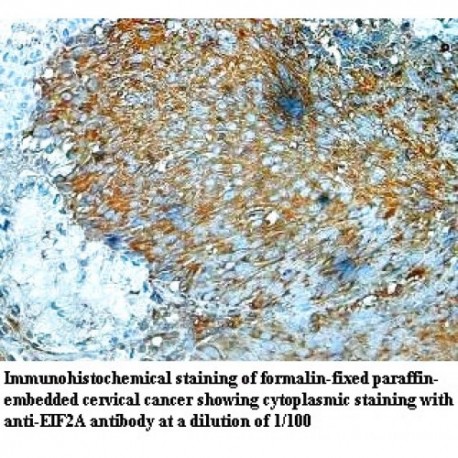 EIF2A Antibody