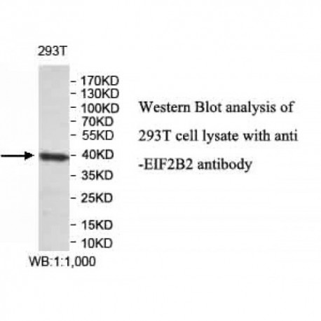 EIF2B2 Antibody