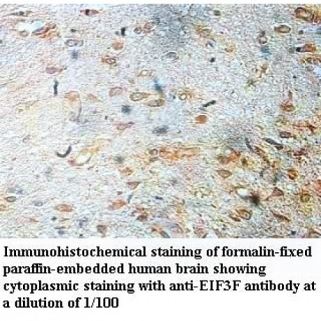 EIF3F Antibody