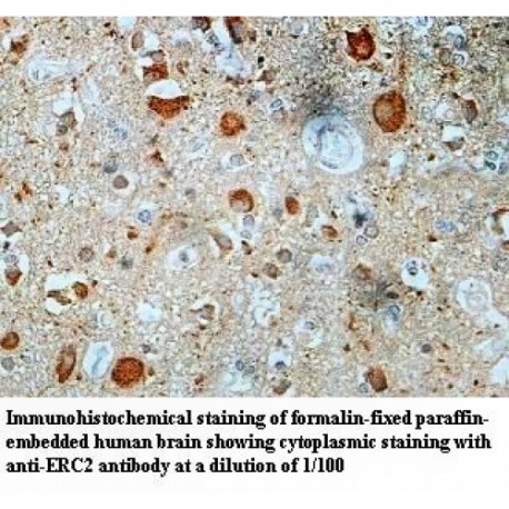 ERC2 Antibody