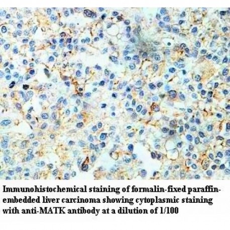 MATK Antibody