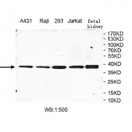 MBNL3 Antibody