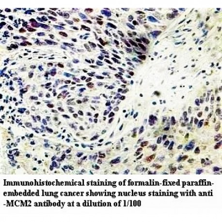 MCM2 Antibody