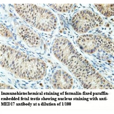 MED17 Antibody