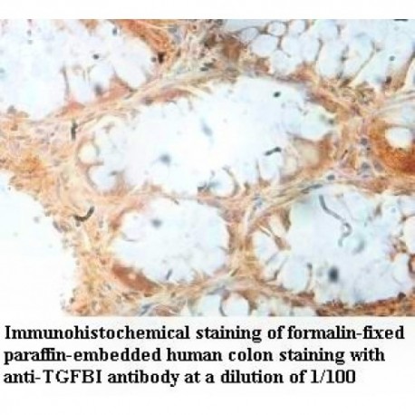 TGFBI Antibody