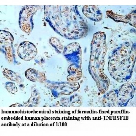 TNFRSF1B Antibody