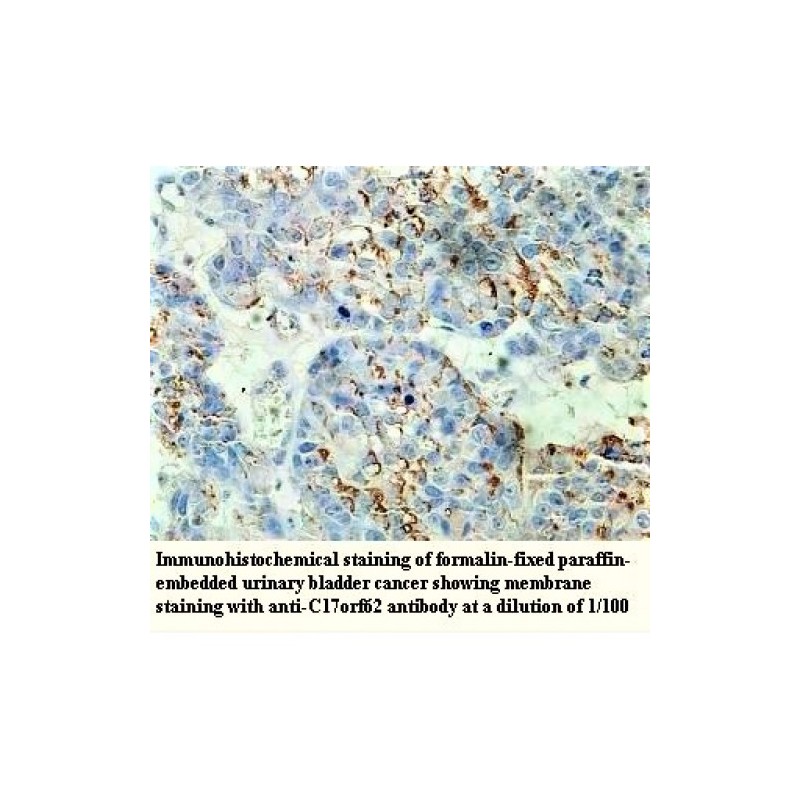 c17orf62 Antibody Supplier | CAS | AOBIOUS