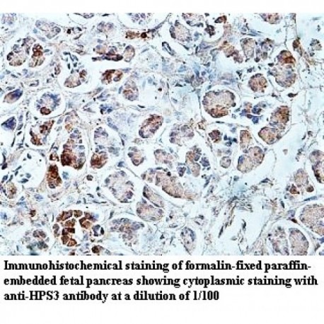 HPS3 Antibody