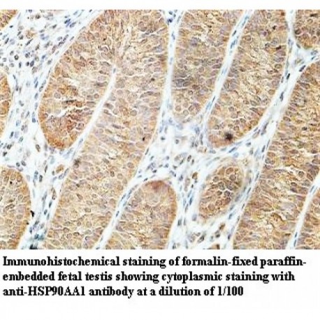 HSP90AA1 Antibody