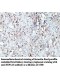 HSPA14 Antibody