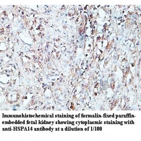 HSPA14 Antibody