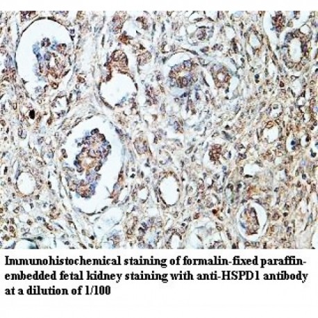 HSPD1 Antibody