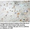 TKTL2 Antibody