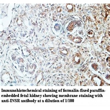 INSR Antibody