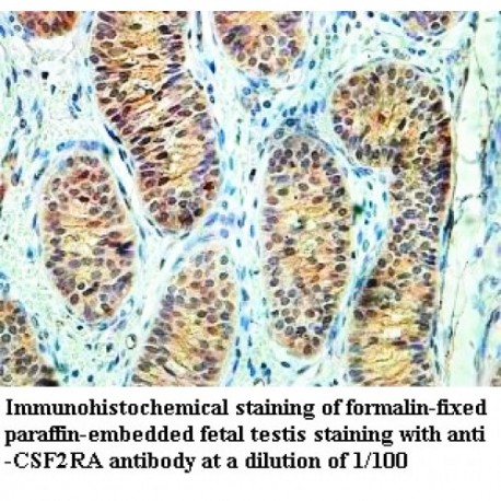 CSF2RA Antibody