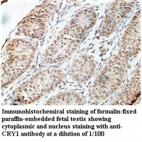 CRY1 Antibody