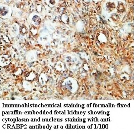 CRABP2 Antibody