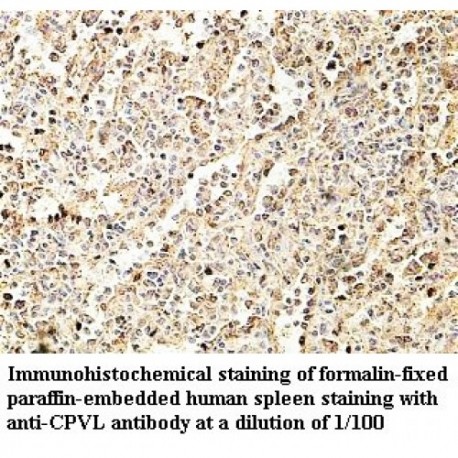 CPVL Antibody