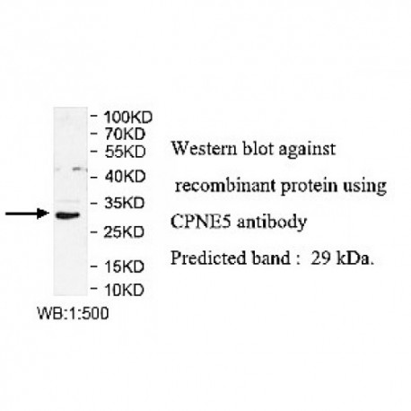 CPNE5 Antibody