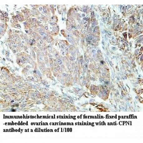 CPN1 Antibody