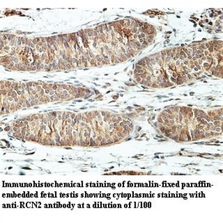 RCN2 Antibody