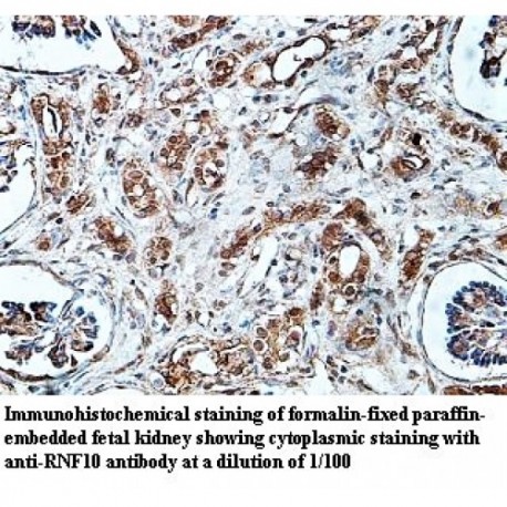 RNF10 Antibody