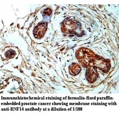 RNF14 Antibody