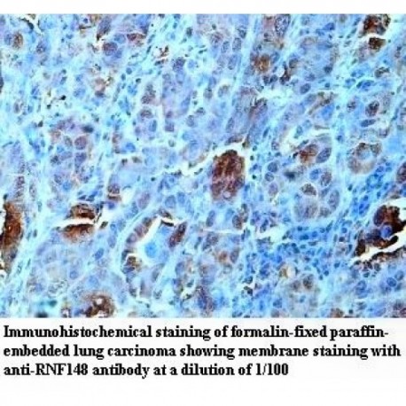 RNF148 Antibody