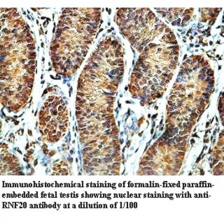 RNF20 Antibody