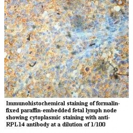 RPL14 Antibody