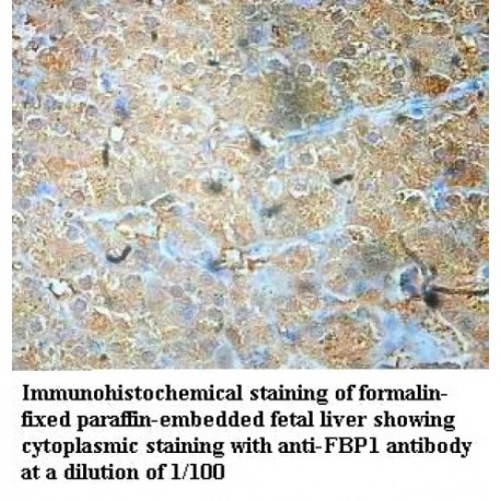 FBP1 Antibody