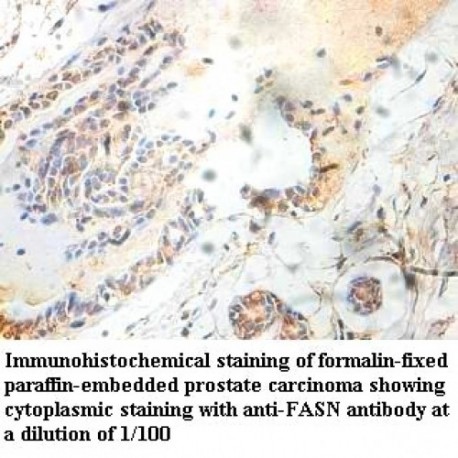 FASN Antibody